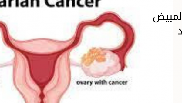 علاج سرطان المبيض في الهند